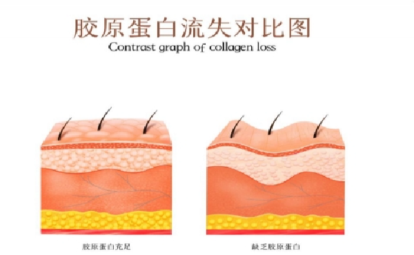 重组ⅲ型胶原蛋白：美尚洁生物 打造新一代美容抗衰“神器”